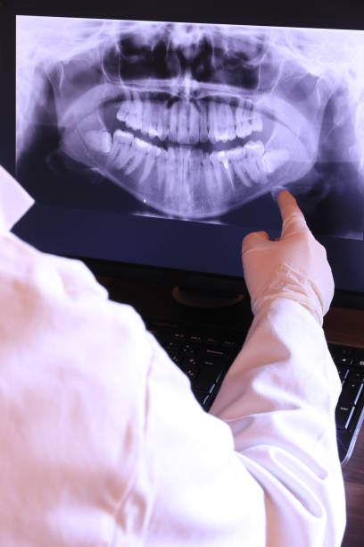 Best Emergency Tooth Extraction in College Park, MD